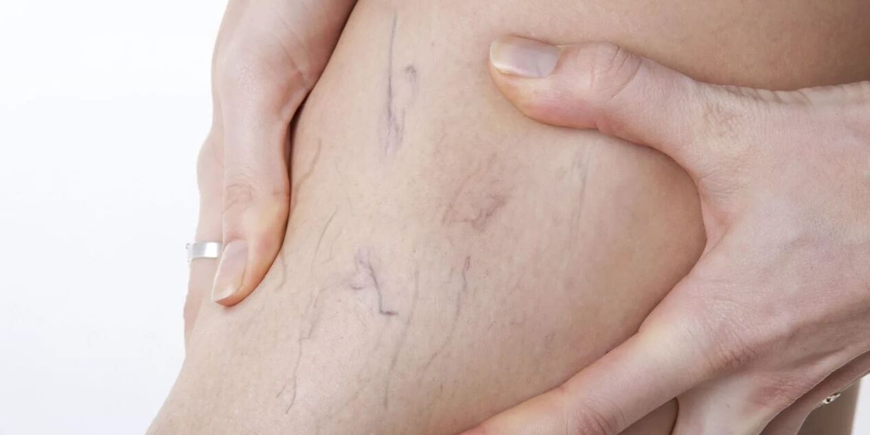 Before using the acrobatic cream