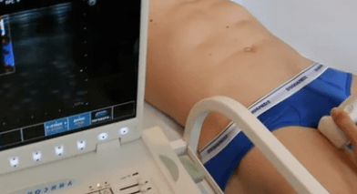 Diagnosis of varicose veins in the lower limbs
